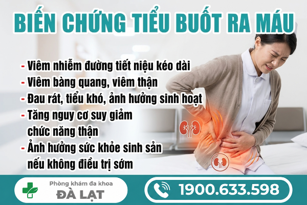 Hình ảnh minh họa